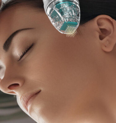 Light Touch Laser Spa NYC Face Microneedling session Manhattan laser hair removal spa buy online