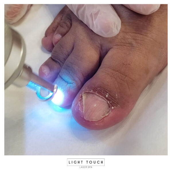 Laser Touch laser spa NYC Manhattan nail laser therapy Hair removal and more advanced treatment for you and you body2