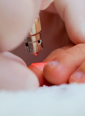 Light Touch Laser Spa NYC Fungus laser removal for feet Manhattan laser hair removal spa buy online