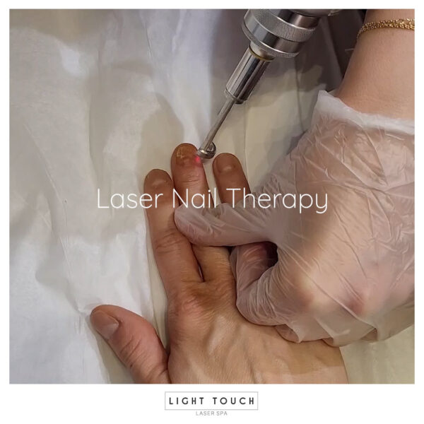 Light Touch Laser Spa NYC Laser Nail Therapy advanced laser treatments